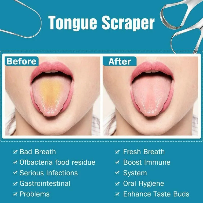 Raspadores de Língua (TESTE 2)